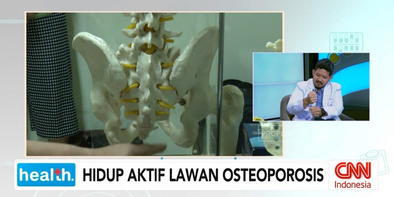 Lawan Osteoporosis Dengan Gaya Hidup Sehat Dan Nutrisi Tepat