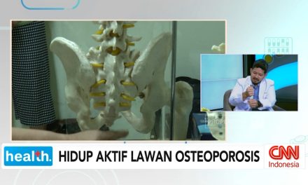 Lawan Osteoporosis Dengan Gaya Hidup Sehat Dan Nutrisi Tepat